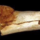 Люди болели раком уже 1,7 млн лет назад — Палеонтологи