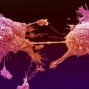 Российские ученые «обучают» ультразвук обнаруживать и убивать раковые клетки