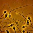 Исследование: количество сперматозоидов у западных мужчин катастрофически снижается с начала семидесятых годов