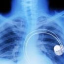 Гибкая органическая батарея произведёт революцию в медицинских имплантатах