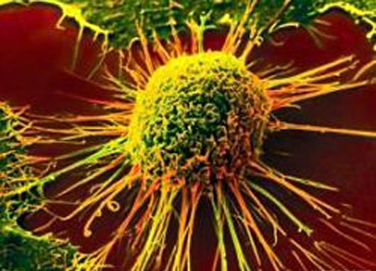 Ученые раскрыли механизм возникновения рецидива рака