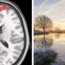 Учёные впервые записали ностальгическую реакцию в мозге с помощью МРТ-сканирования