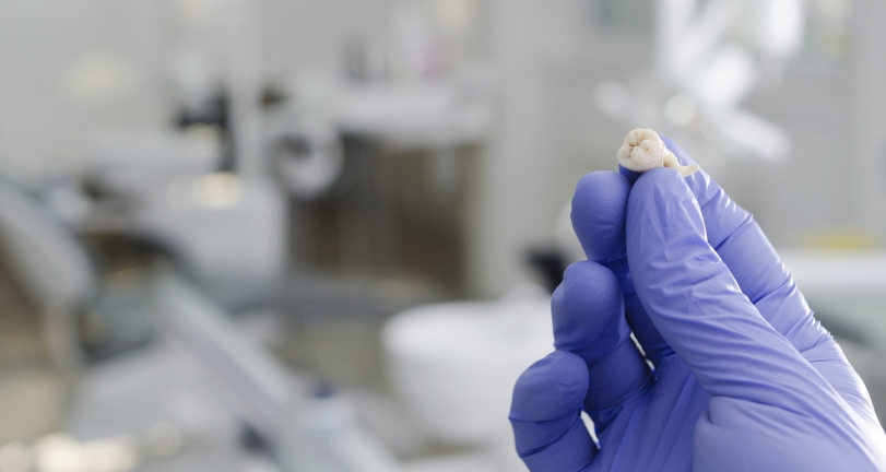 Устройство для «раскалывания» зубов поможет извлекать стволовые клетки