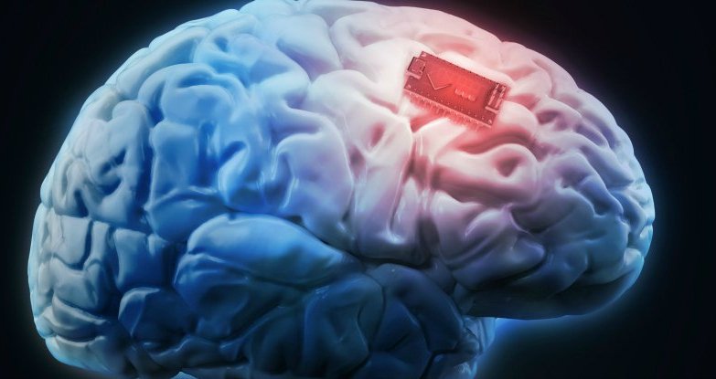 Впервые в истории учёные улучшили человеческую память с помощью имплантата мозга