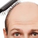 Хорошая новость для лысых: исследователи утверждают, что они создали вещество, вызывающее появление волос