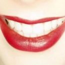 Почему белозубая улыбка отнюдь не свидетельствует о здоровье зубов