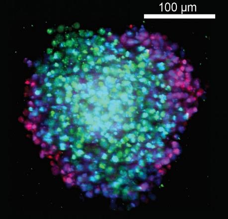 Сферические агломераты опухолевых клеток помогают учёным отыскивать более эффективные лекарства от рака