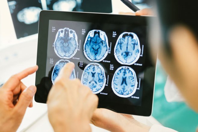 Новая технология способна революционизировать операции по удалению опухолей в головном мозге