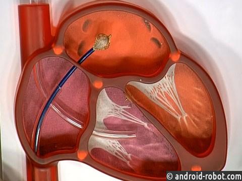 Ученые открыли способ защитить мозг от последствий ишемии Ученые открыли способ защитить мозг от последствий ишемии