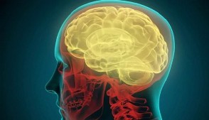 Британские ученые обнаружили возможную причину возникновения рассеянного склероза