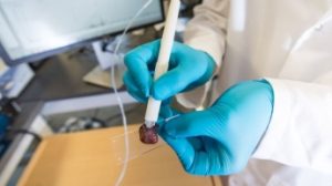 Ручка MasSpec способна в течение десяти секунд определить наличие в ткани злокачественных клеток