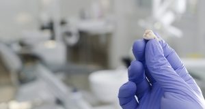 Устройство для «раскалывания» зубов поможет извлекать стволовые клетки