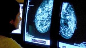 Похудение может снизить риск развития рака молочной железы Похудение может снизить риск развития рака молочной железы