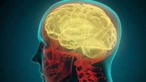 Имплантат мозга может остановить сексуальных насильников и предотвратить самоубийства