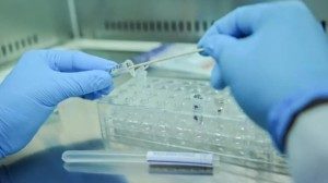 Учёные подошли на шаг ближе к лечению рассеянного склероза Учёные подошли на шаг ближе к лечению рассеянного склероза