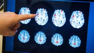 Почему пожилые люди склонны к рассеяноости? Почему пожилые люди склонны к рассеяноости?
