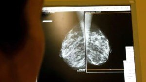 Женщина излечилась от рака молочной железы после того, как врачам удалось использовать для лечения её собственную иммунную систему Женщина излечилась от рака молочной железы после того, как врачам удалось использовать для лечения её собственную иммунную систему