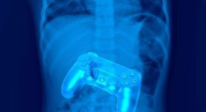 Проглатываемый контроллер перемещает игру с экрана монитора прямо в желудочно-кишечный тракт геймера